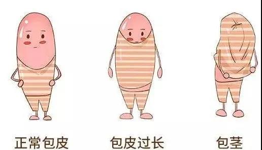 【保山安利醫(yī)院】家長速看！暑期包皮手術預約正當時！